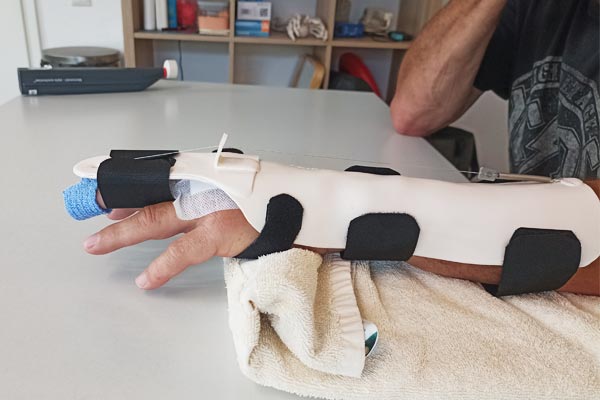 Ergo Aktiv Haiger // Handtherapie Schienen