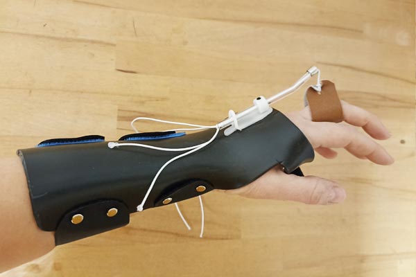 Ergo Aktiv Haiger // Handtherapie Schienen